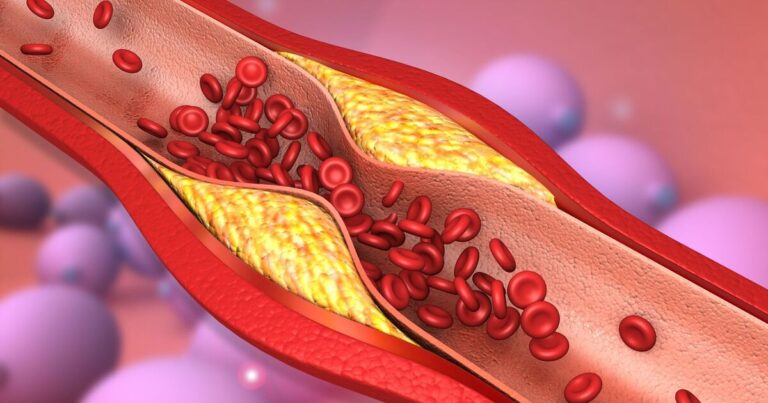 cholesterol-superfood-rivals-aspirin-in-artery-health-claims-expert